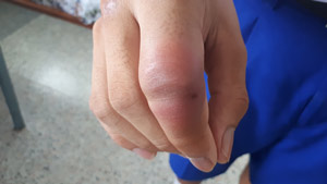 深圳腹部CT檢查費用參考